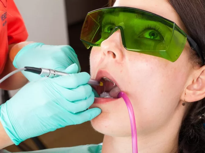 Terapie laser - laserul in stomatologie, coroana zirconiu